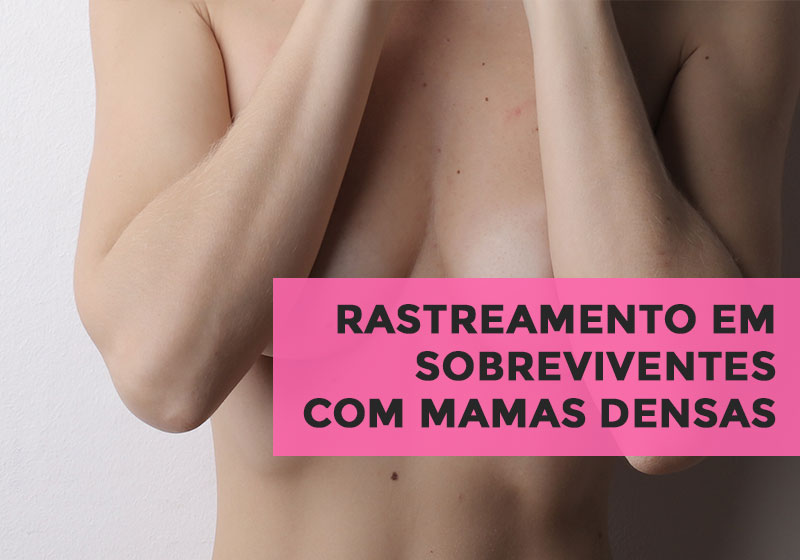 mamas densas